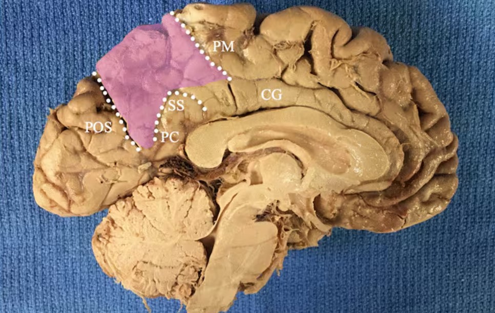 La investigación apunta al precúneo anterior, una región cerebral vinculada con el procesamiento del “yo físico”.