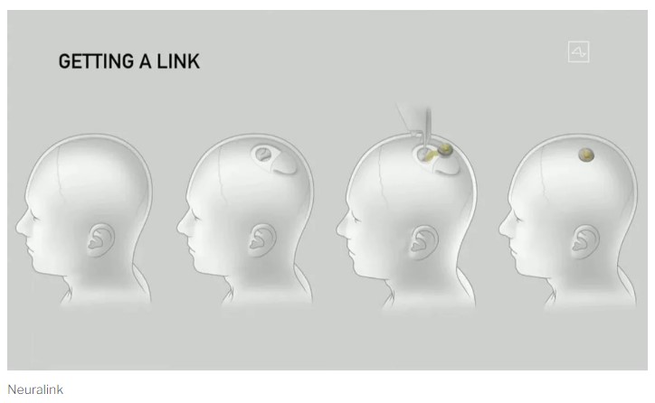 Neuralink sostiene un atraso de dos años con respecto a sus planes originales.